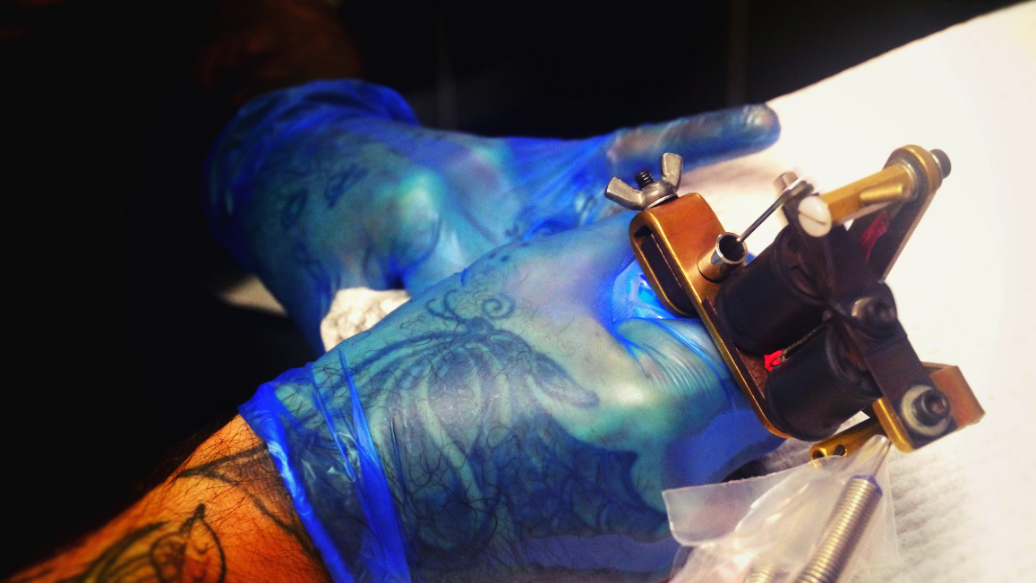 Newcastle tattoo removal